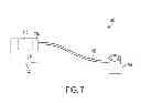 Fig. 14 - METHOD AND SYSTEM FOR APPLICATION OF THERMAL THERAPY RELATIVE TO THE TREATMENT OF DEEP-VEIN THROMBOSIS AND LYMPHEDEMA