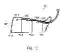 Fig. 17 - METHOD AND SYSTEM FOR APPLICATION OF THERMAL THERAPY RELATIVE TO THE TREATMENT OF DEEP-VEIN THROMBOSIS AND LYMPHEDEMA