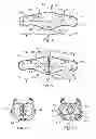 Fig. 02 - Lumbar support belt