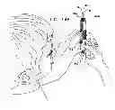 Fig. 12 - Automatic injection device