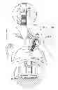 Fig. 13 - Automatic injection device