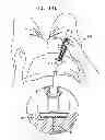 Fig. 15 - Automatic injection device