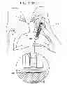 Fig. 17 - Automatic injection device