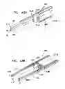 Fig. 52 - Automatic injection device