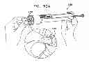 Fig. 60 - Automatic injection device