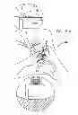 Fig. 62 - Automatic injection device