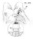 Fig. 64 - Automatic injection device