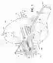 Fig. 02 - Medical device