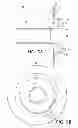 Fig. 06 - Medical device