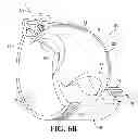 Fig. 08 - Medical device