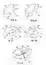 Fig. 08 - Joint arthroplasty devices and surgical tools