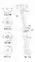 Fig. 22 - Joint arthroplasty devices and surgical tools