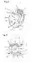 Fig. 02 - Receiving part for connecting a shank of a bone anchoring element to a rod and bone anchoring device with such a receiving part