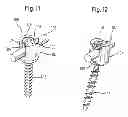 Fig. 07 - Receiving part for connecting a shank of a bone anchoring element to a rod and bone anchoring device with such a receiving part