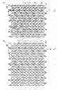 Fig. 04 - INTRAVASCULAR STENTS