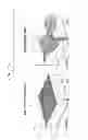Fig. 114 - Multi-Dimensional Error Definition, Error Measurement, Error Analysis, Error Function Generation, Error Information Optimization, and Error Correction for Communications Systems