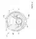 Fig. 26 - Interchangeable pressure sensor assembly and methods of assembly