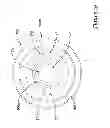 Fig. 24 - Joint between a pressure sensor and a pressure port of a sensor assembly