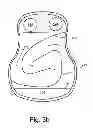 Fig. 05 - Stringed instruments with internal baffling