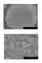Fig. 04 - POSITIVE ELECTRODE ACTIVE SUBSTANCE PRECURSOR PARTICLES, POSITIVE ELECTRODE ACTIVE SUBSTANCE PARTICLES AND NON-AQUEOUS ELECTROLYTE SECONDARY BATTERY