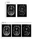Fig. 07 - Method to generate magnetic resonance exposures