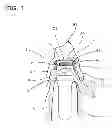 Fig. 02 - Denture attachment