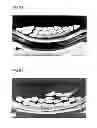 Fig. 04 - High-density fabric