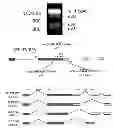 Fig. 01 - KLF6 ALTERNATIVE SPLICE FORMS AND A GERMLINE KLF6 DNA POLYMORPHISM ASSOCIATED WITH INCREASED CANCER RISK
