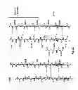 Fig. 09 - CRYSTAL STRUCTURE OF STAPHYLOCOCCUS AUREUS CLUMPING FACTOR A IN COMPLEX WITH FIBRINOGEN DERIVED PEPTIDE AND USES THEREOF