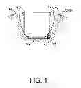 Fig. 02 - Applicators and methods for intraoperative treatment of proliferative diseases of the breast