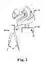 Fig. 02 - Tools and methods for treatment of pelvic conditions