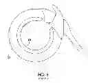 Fig. 09 - Adjustable implant and method of use