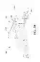 Fig. 35 - Adjustable implant and method of use