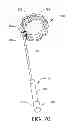 Fig. 71 - Adjustable implant and method of use