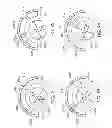 Fig. 89 - Adjustable implant and method of use