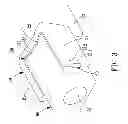 Fig. 04 - Endoscope with a flexible circuit board