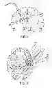 Fig. 09 - Multi-directional microfluidic drug delivery device