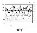 Fig. 09 - Respiratory motion detection apparatus