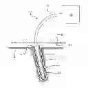 Fig. 01 - TUNNEL DRESSING FOR USE WITH NEGATIVE PRESSURE WOUND THERAPY SYSTEM