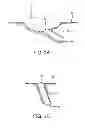 Fig. 04 - TUNNEL DRESSING FOR USE WITH NEGATIVE PRESSURE WOUND THERAPY SYSTEM