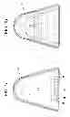 Fig. 02 - Ostomy Pouch Comprising Absorbent Material