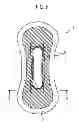 Fig. 05 - Absorbent article with pressed grooves overlying a compressed region and method of manufacturing the same