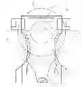 Fig. 01 - Disposable diaper with attached wrapper for enclosing and sealing the diaper when soiled