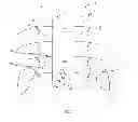Fig. 02 - Noninvasive Nerve Ablation