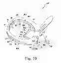 Fig. 22 - Patella resection guide with locating features and method of using the same