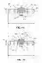 Fig. 05 - Suspension device to anchor tissue graft