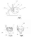 Fig. 05 - Method for controlling a measurement process by means of virtual surfaces