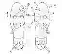 Fig. 01 - Traction Reducing Apparatus