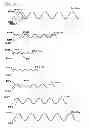 Fig. 04 - Air filter arrangement; assembly; and, methods