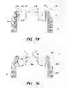 Fig. 08 - Plastic aerosol container and method of manufacture